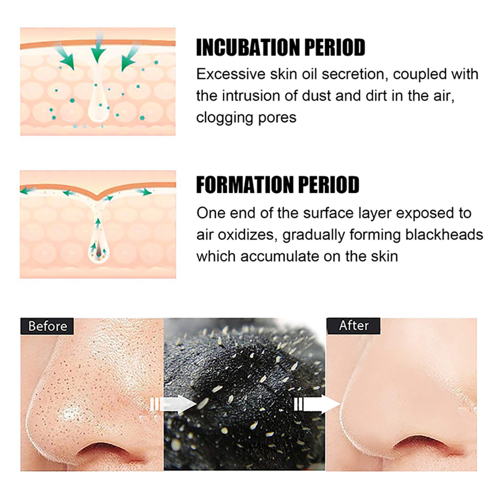 لاصقات إزالة الرؤوس السوداء من - مراجعة Nasal Aspirator وسعره